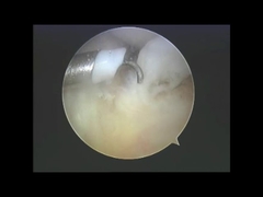 Produits à base d'alcool