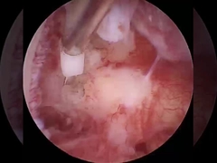 Produits à base d'alcool